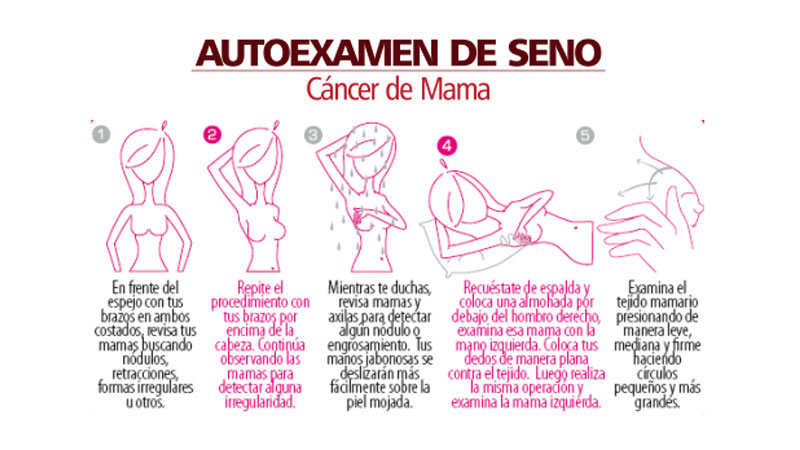 autoexamen de mamas